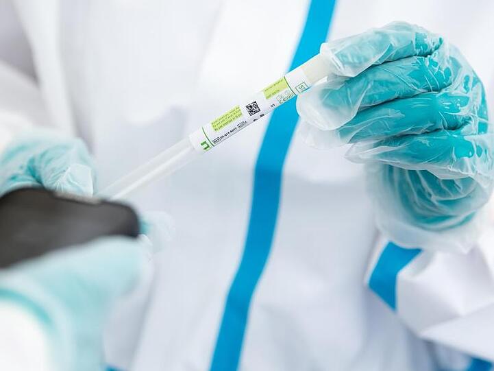 Die Corona-Infektionszahlen steigen in Deutschland weiter an.