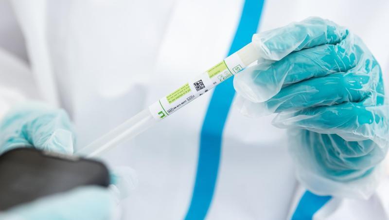 Die Corona-Infektionszahlen steigen in Deutschland weiter an. Die Corona-Infektionszahlen steigen in Deutschland weiter an.