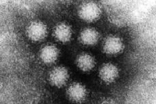 Das Noro-Virus
