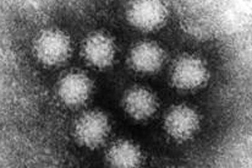 So sieht das fiese Noro-Virus unter dem Mikroskop aus.