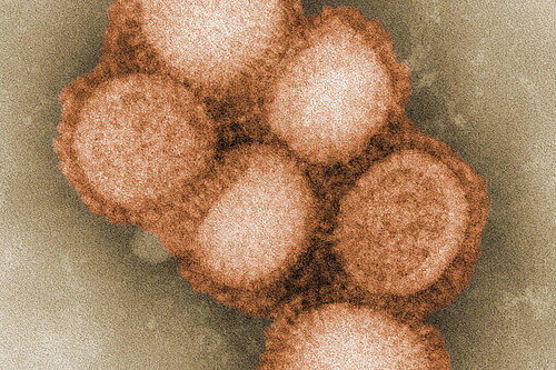 Das Serum gegen das Schweinegrippe-Virus ist seit Dienstagabend in Nürnberg kaum mehr zu haben.