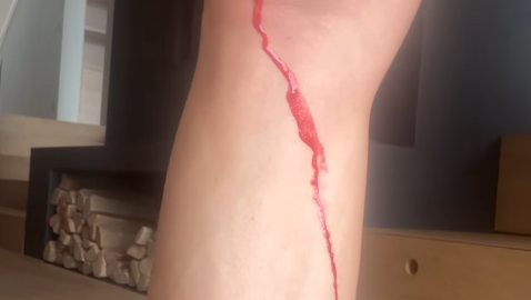 Autsch: Bei einem Sturz hat sich Cathy Hummels das Knie aufgeschlagen. Autsch: Bei einem Sturz hat sich Cathy Hummels das Knie aufgeschlagen.
