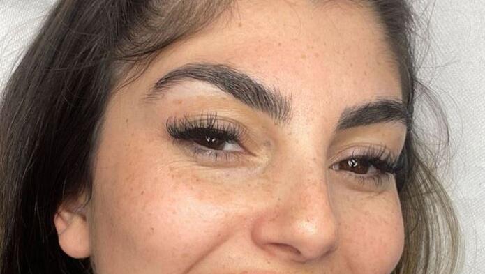 So schaut Yeliz Koc aus, nachdem ihre Lippen behandelt wurden. Was hat sie machen lassen? So schaut Yeliz Koc aus, nachdem ihre Lippen behandelt wurden. Was hat sie machen lassen?