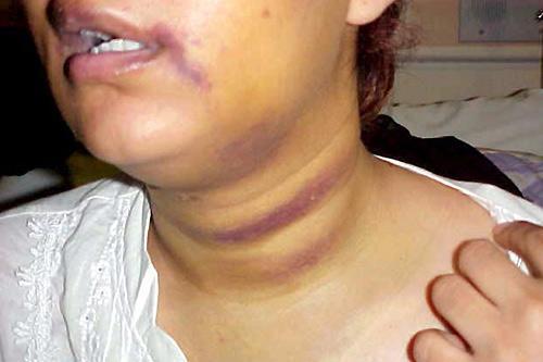 Eine misshandelte saudische Frau soll die ausnahme werden