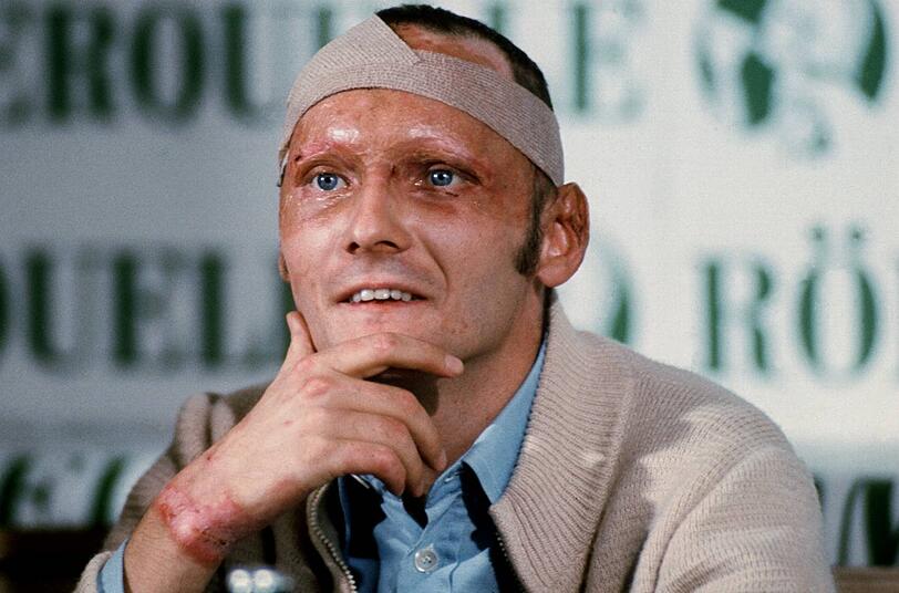 Nach dem Unfall: Niki Lauda gibt am 08.09.1976 eine Pressekonferenz in Salzburg.