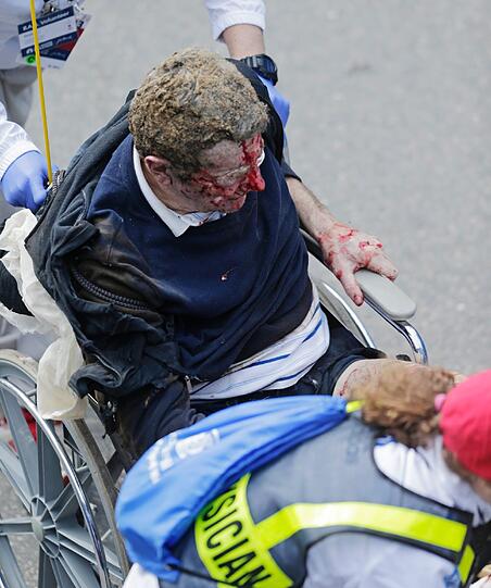 Drei Tote und mehr als 140 Verletzte - Bilder vom Bombenterror in Boston