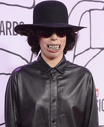 Pop-Star Lady Gaga zeigt Zähne: Der Megastar erschien bei den Youtube Awards in Los Angeles mit einem Riesen-Gebiss.