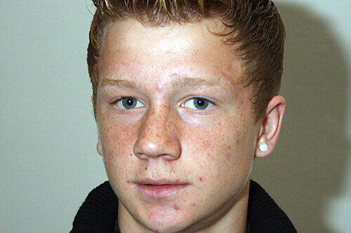 Das Opfer: Edgar W. (16) hat immer noch starke Schmerzen.