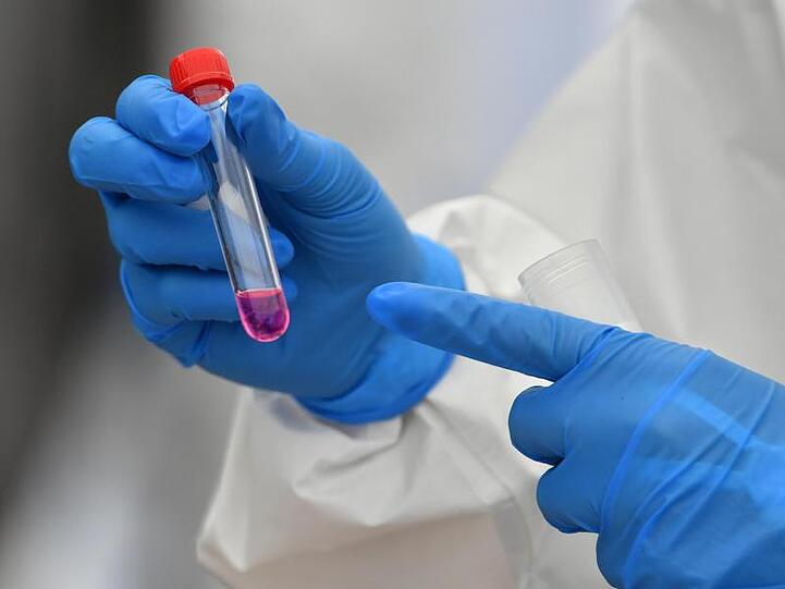 Eine Mitarbeitin hält ein Röhrchen mit einer Nährlösung für einen Corona-Test in der Hand. Foto: Hendrik Schmidt/dpa-Zentralbild/ZB/Symbolbild