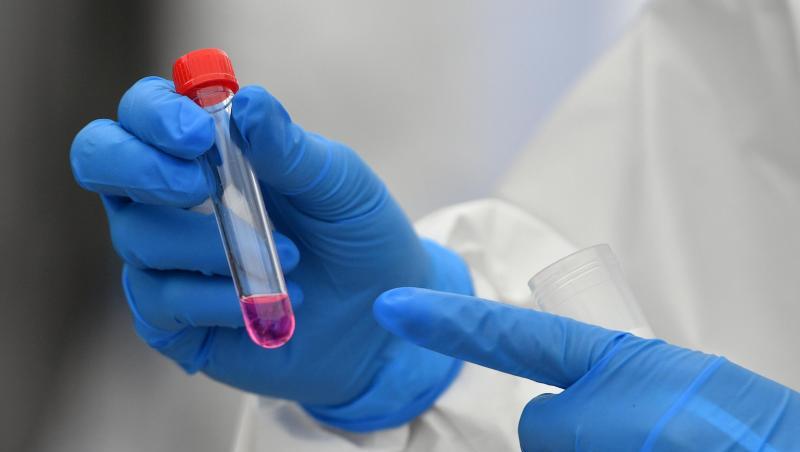 Eine Mitarbeitin hält ein Röhrchen mit einer Nährlösung für einen Corona-Test in der Hand. Foto: Hendrik Schmidt/dpa-Zentralbild/ZB/Symbolbild Eine Mitarbeitin hält ein Röhrchen mit einer Nährlösung für einen Corona-Test in der Hand. Foto: Hendrik Schmidt/dpa-Zentralbild/ZB/Symbolbild