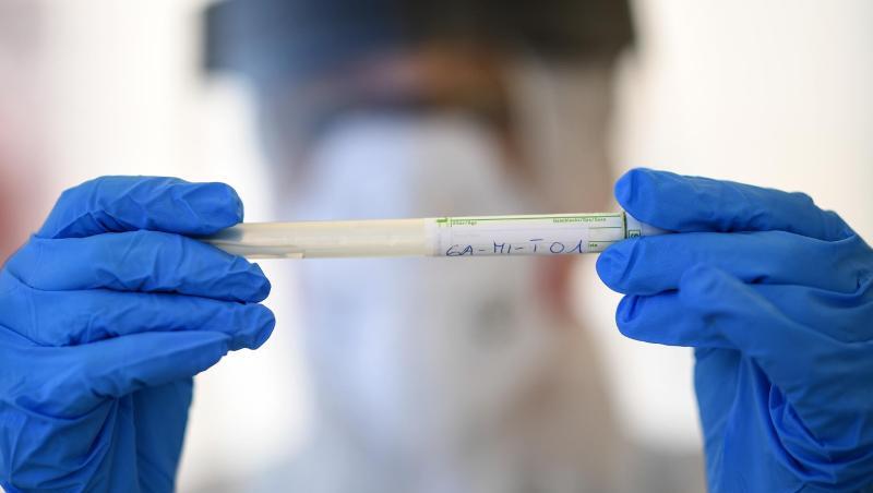 Ein Mitarbeiter vom Gesundheitsamt hältt ein Test-Röhrchen. Foto: Britta Pedersen/dpa-Zentralbild/dpa/Symbolbild Ein Mitarbeiter vom Gesundheitsamt hältt ein Test-Röhrchen. Foto: Britta Pedersen/dpa-Zentralbild/dpa/Symbolbild