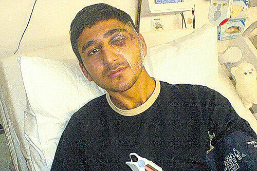 Das Opfer: Einzelhandelskaufmann Mehmet B. (21) wurde von zwei Schlägern schwer verletzt.
