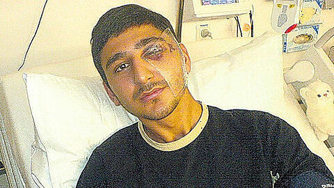 Das Opfer: Einzelhandelskaufmann Mehmet B. (21) wurde von zwei Schlägern schwer verletzt.