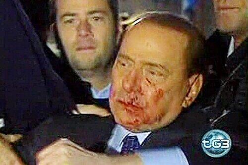 Silvio Berlusconi nach der Attacke