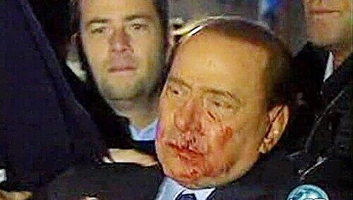 Silvio Berlusconi nach der Attacke Silvio Berlusconi nach der Attacke