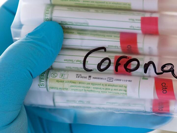 Proben mit Abstrichen werden in einem Labor auf das Coronavirus untersucht.