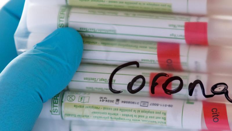 Proben mit Abstrichen werden in einem Labor auf das Coronavirus untersucht. Proben mit Abstrichen werden in einem Labor auf das Coronavirus untersucht.