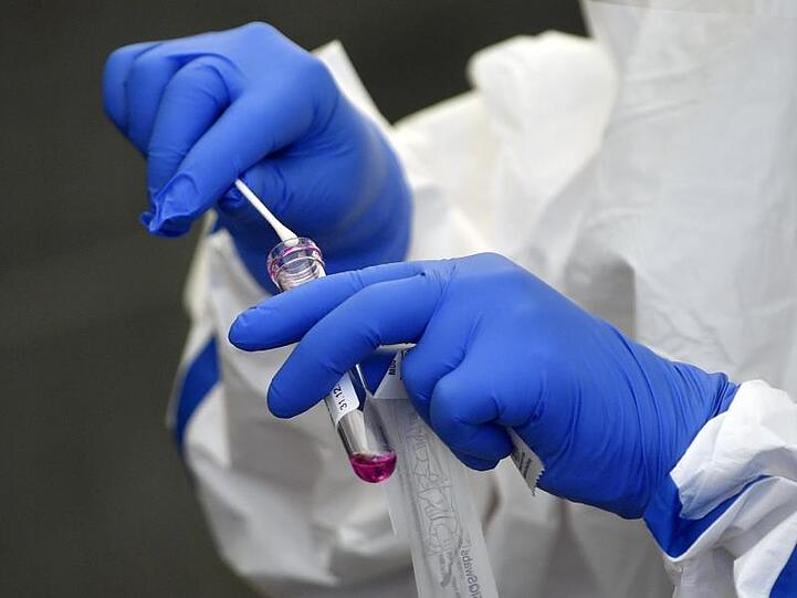 Eine Helferin steckt einen Tupfer mit dem Rachenabstrich eines Patienten in ein Röhrchen.