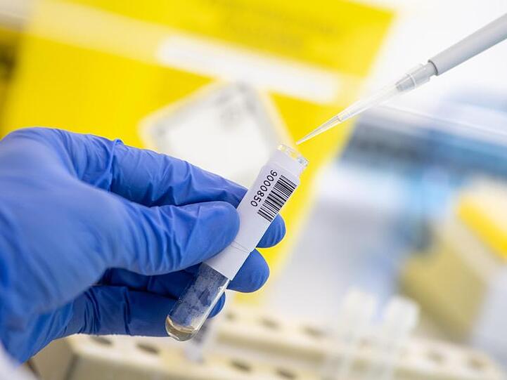 Ein Wissenschaftler nimmt in einem Diagnostiklabor mit einer Pipette abgetrenntes Plasma einer Blutprobe.