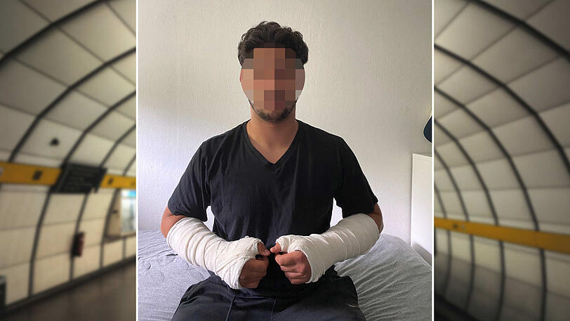Sercan (17) hat beide Arme in Gips. Der Überfall hat sich ganz in der Nähe des U-Bahnhofs Lehel ereignet.