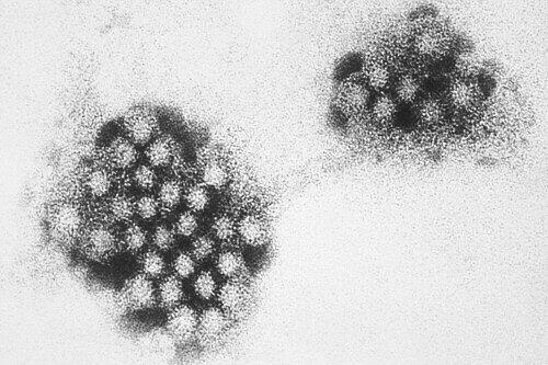 Eine miskroskopische Vergrößerung des Norovirus