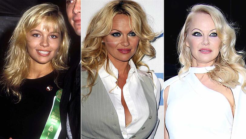Pamela Anderson hat sich über die Jahre optisch stark verändert. Pamela Anderson hat sich über die Jahre optisch stark verändert.