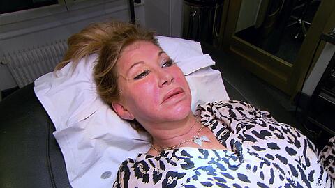 Carmen Geiss unterzog sich einem Vampir-Lifting.