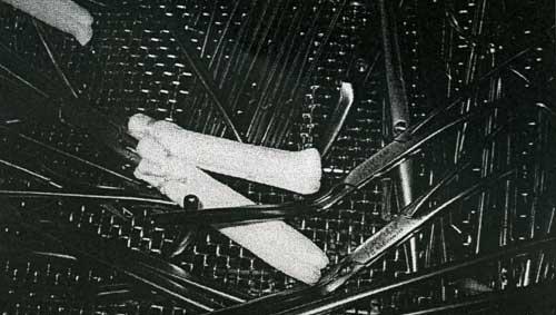 Grausliges Beweisfoto aus dem Gutachten: Knochen- und Nahtreste sind zum Teil nicht vollständig entfernt worden - gereinigt wurde außerdem inklusive Bezugsmaterial aus Baumwolle. Grausliges Beweisfoto aus dem Gutachten: Knochen- und Nahtreste sind zum Teil nicht vollständig entfernt worden - gereinigt wurde außerdem inklusive Bezugsmaterial aus Baumwolle.