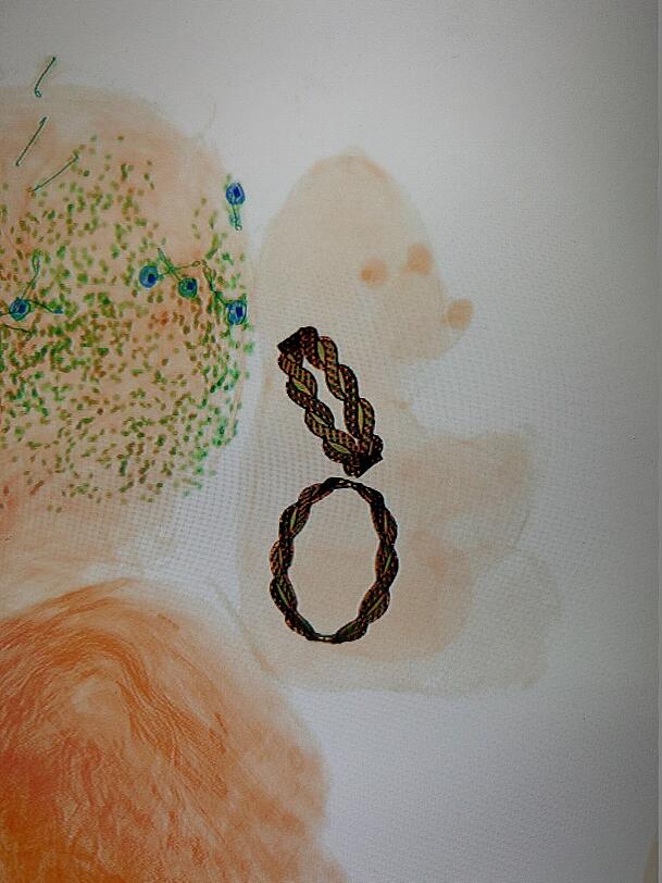 Auf dem Röntgenbild kann man gut die beiden versteckten Goldarmreife erkennen. Auf dem Röntgenbild kann man gut die beiden versteckten Goldarmreife erkennen.
