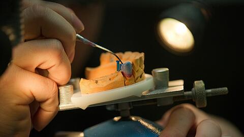 Ein Zahntechniker bei der Arbeit. Foto: Arno Burgi/Illustration