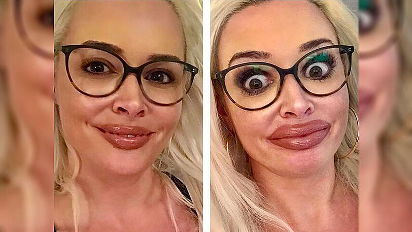 Daniela Katzenberger hat es mit dem Lipgloss etwas zu gut gemeint