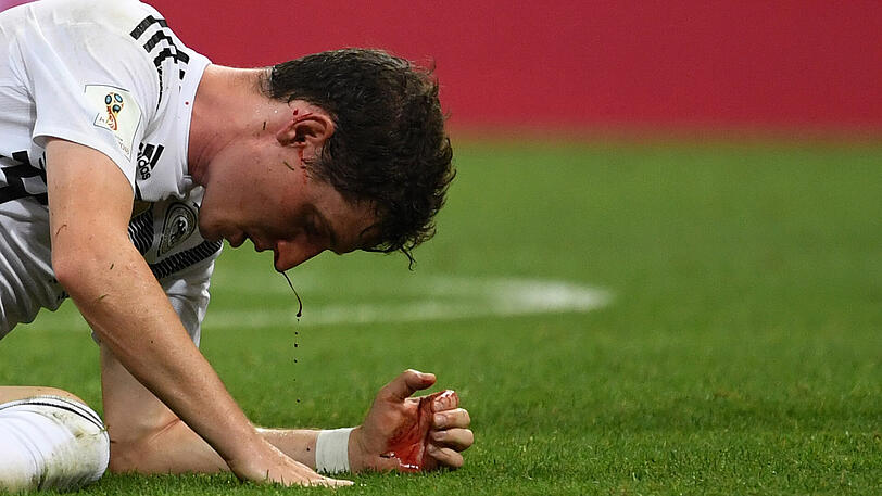 Nach dem unglücklichen Zusammenprall hat sich Sebastian Rudy die Nase gebrochen.