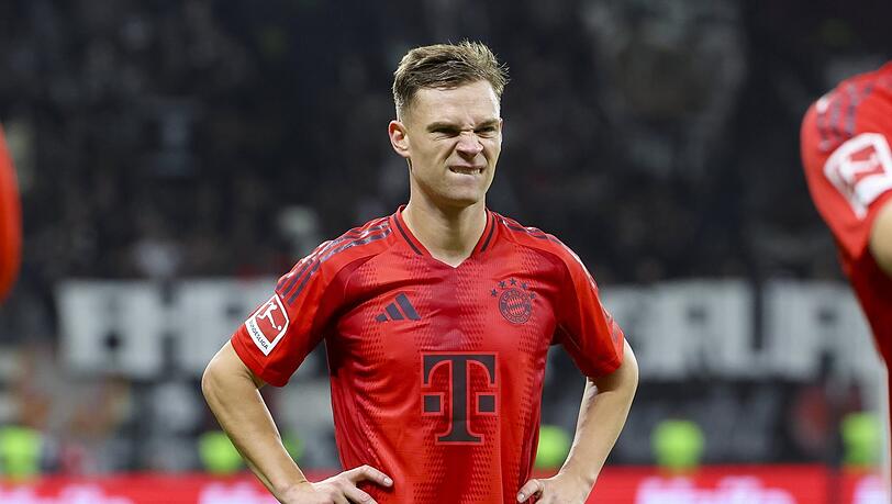 Durchbeißen und weiterarbeiten: Kimmich.
