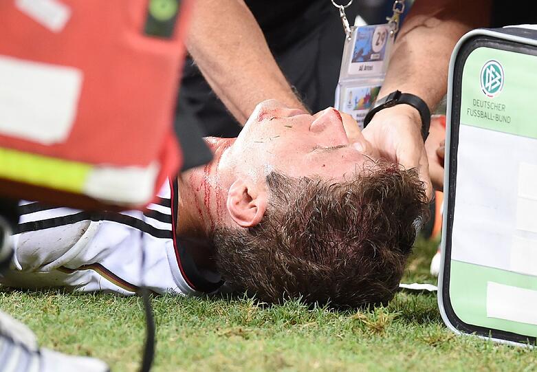 Thomas Müller verletzte sich im Spiel gegen Ghana und erlitt einen Cut über dem Auge.