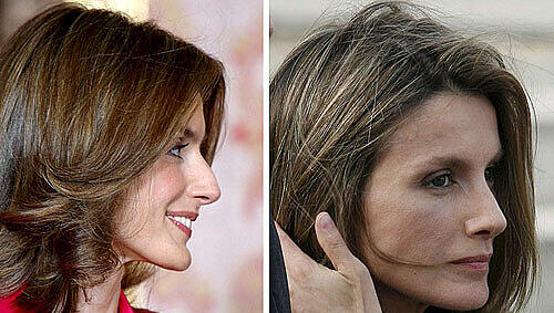Prinzessin Letizia von Spanien hat sich wegen ihrer Nase unters Messer begeben. Angeblich nur, um Atembeschwerden zu beheben, sagten Palastsprecher. Prinzessin Letizia von Spanien hat sich wegen ihrer Nase unters Messer begeben. Angeblich nur, um Atembeschwerden zu beheben, sagten Palastsprecher.