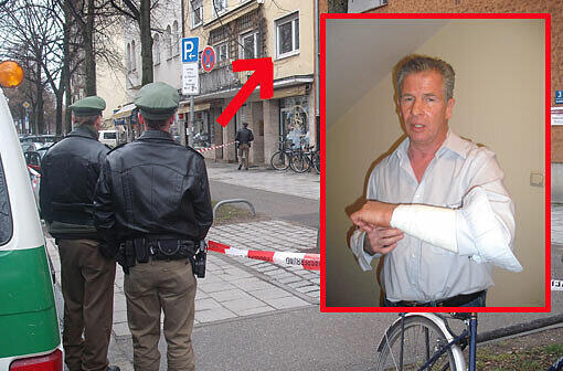 Manager Alexander M. wurde von Katja S. mit dem Küchenmesser böse am Arm erwischt. In der AZ spricht er über die Attacke der Frau.