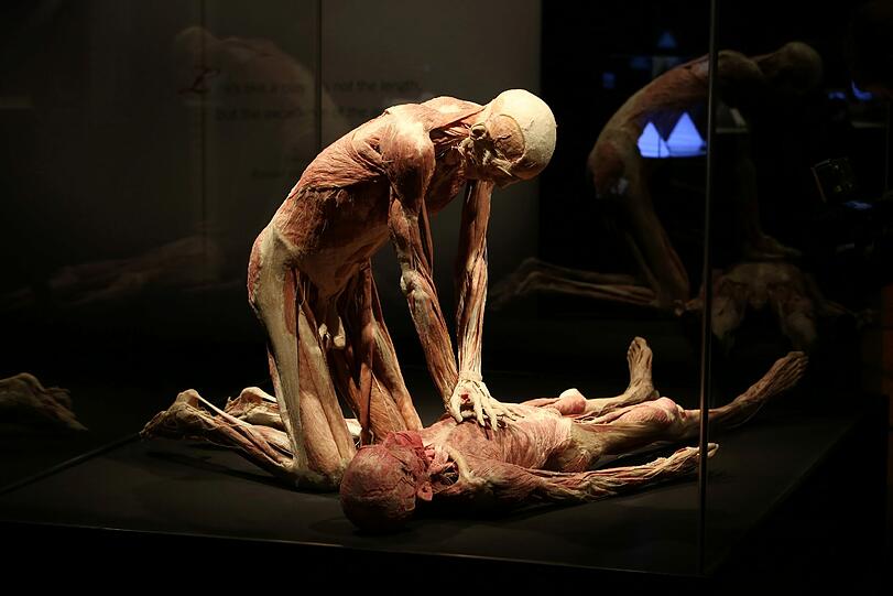Wiederbeleben zwecklos: Die Herzmassage kommt für den Körper am Boden zu spät (oben). Sie passt aber zum Thema der Ausstellung: dem Verlauf von der Geburt bis zum Tod.