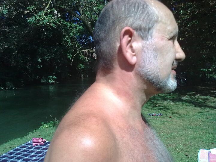 Rote Druckstellen, erhebliche Schmerzen: An dem Hals von Willi Kling (67) sieht man die Male, die ihm ein Polizist zugefügt haben soll.