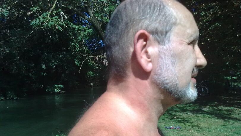 Rote Druckstellen, erhebliche Schmerzen: An dem Hals von Willi Kling (67) sieht man die Male, die ihm ein Polizist zugefügt haben soll.