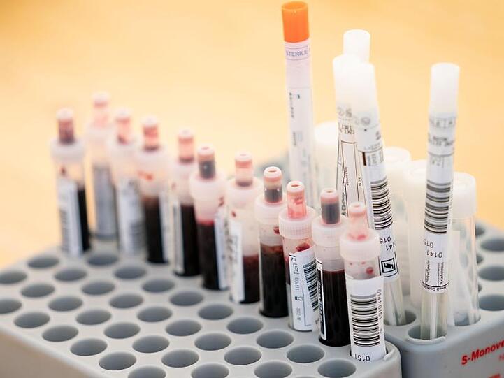Entnommene Abstrichtests und Blutproben. Foto: Kay Nietfeld/dpa