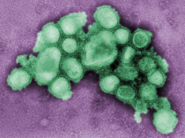 So sieht es aus: das Schweinegrippen-Virus.