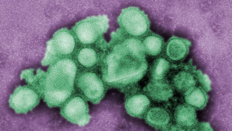So sieht es aus: das Schweinegrippen-Virus. So sieht es aus: das Schweinegrippen-Virus.