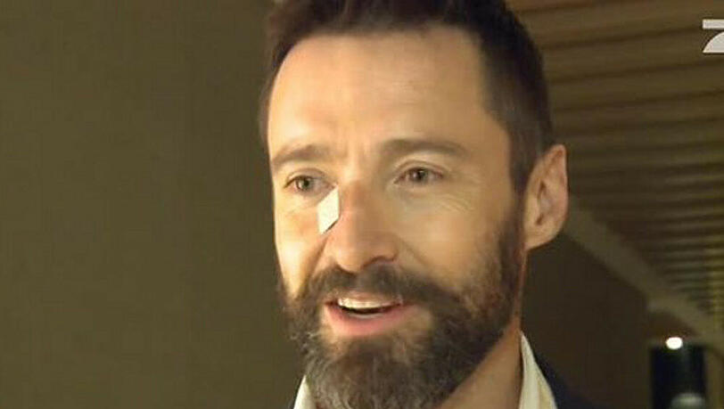 Hugh Jackman ist auch mit Nasenpflaster professionell und sympathisch Hugh Jackman ist auch mit Nasenpflaster professionell und sympathisch