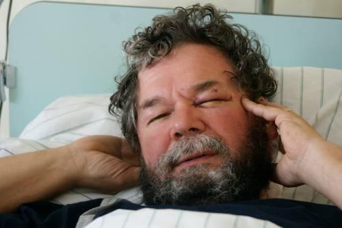 Das Opfer Heiner Schuck kam mit Prellungen und Schwellungen in eine Klinik