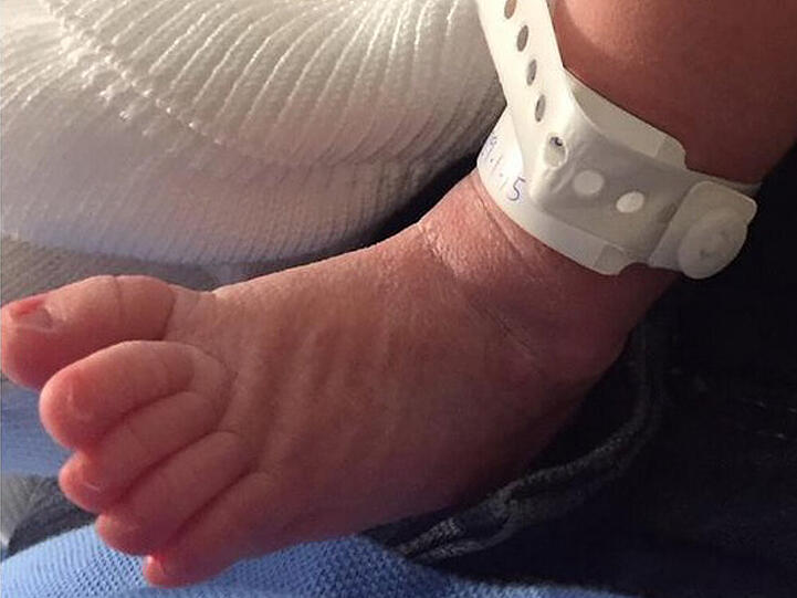 Die krummen Zehen von Shakiras zweitem Sohn Sasha
