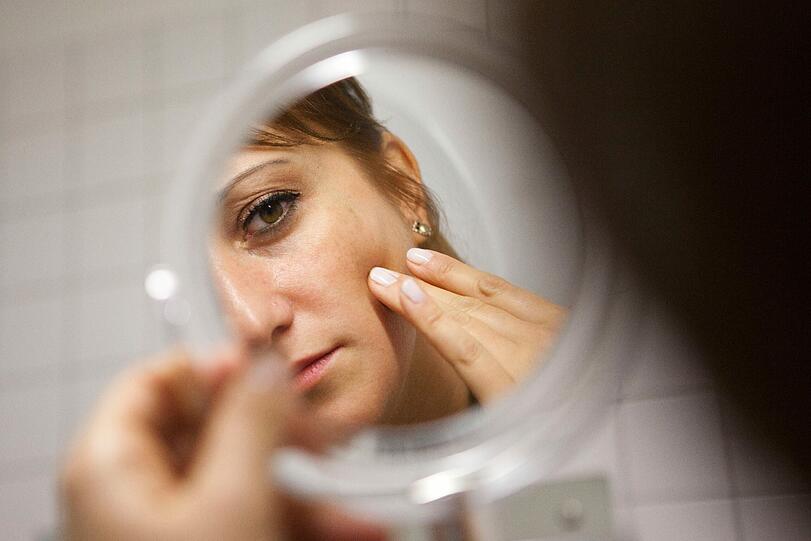 Auch wer die Pubertät längst hinter sich hat, ist nicht vor Akne gefeit - manchmal zeigt sich das veränderte Hautbild auch erst jenseits der 30.