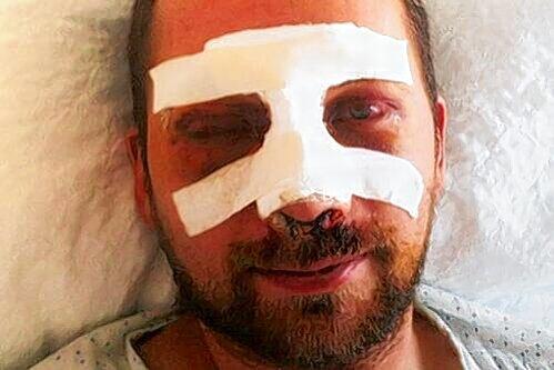 Grün und blau geschlagen: Tobias B. nach der Attacke im Klinikum rechts der Isar.