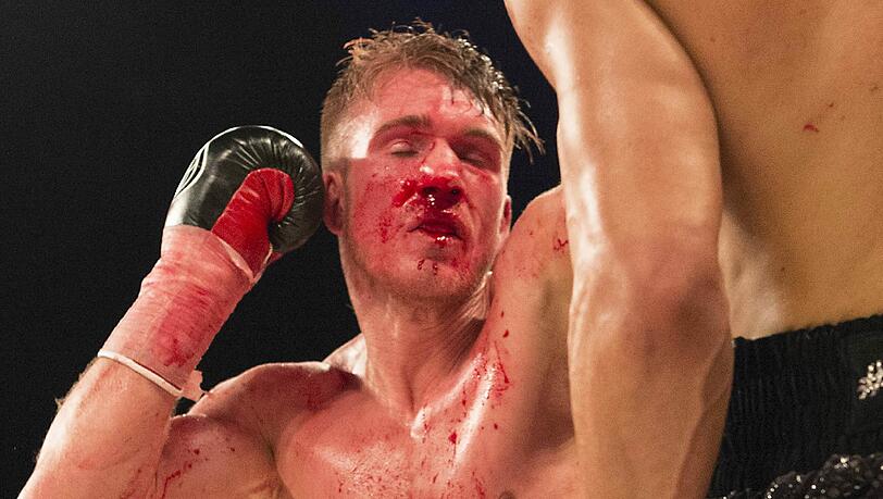 Nick Blackwell (Foto) hat bei seinem Kampf gegen Chris Eubank junior eine Hirnblutung davongetragen. Nick Blackwell (Foto) hat bei seinem Kampf gegen Chris Eubank junior eine Hirnblutung davongetragen.