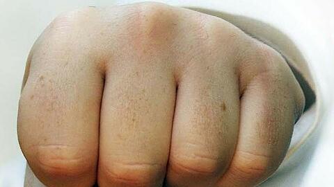 Auf dem Optimolgelände ist ein 19-Jähriger ausgerastet. Jetzt ermittelt die Polizei wegen versuchten Totschlags. (Symbolbild)