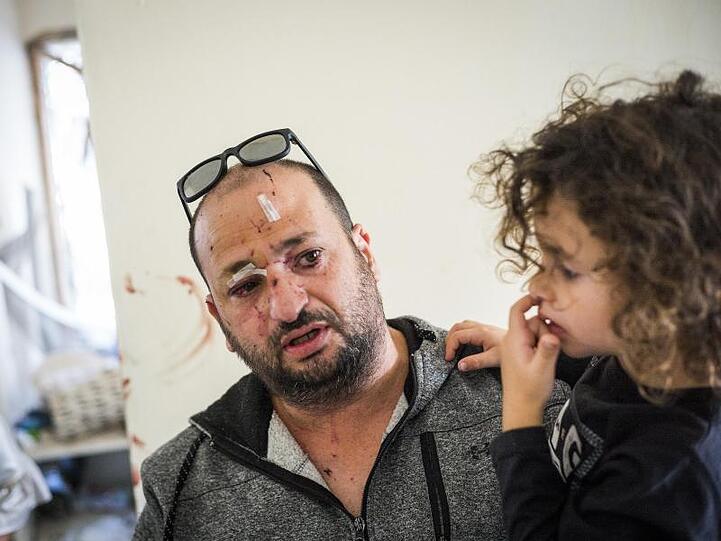Ein verletzter Israeli trägt sein Kind auf dem Arm, während er in seiner beschädigten Wohnung steht, die von einer Rakete aus dem Gazastreifen getroffen wurde.